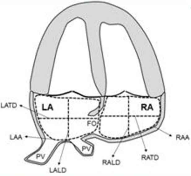 dimensiones_auriculares_dibujo