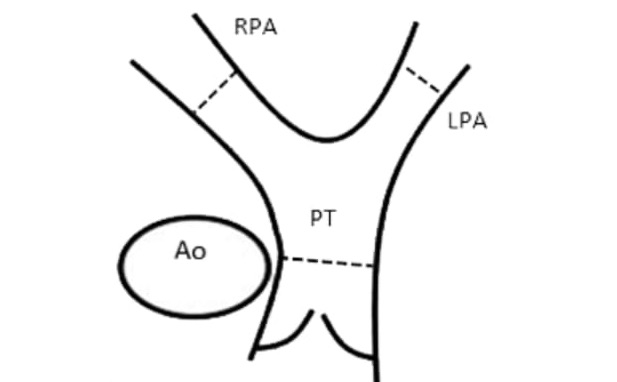 dimensiones_pulmonares_dibujo_1