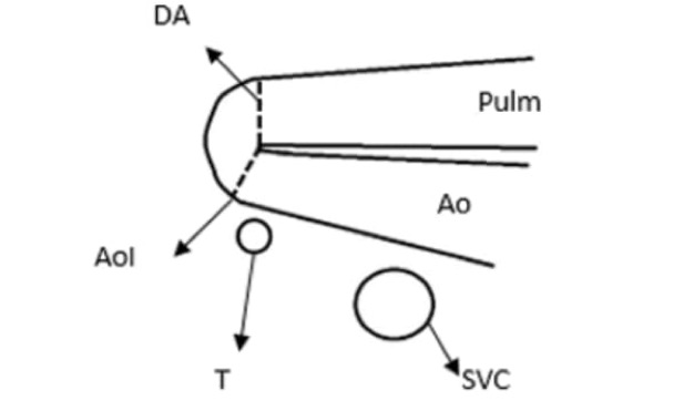 dimensiones_pulmonares_dibujo_2