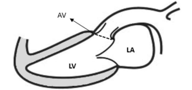 dimensiones_valvulares_3_dibujo