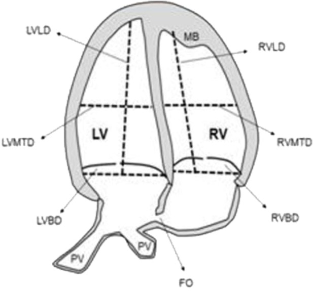 dimensiones_ventriculares_dibujo